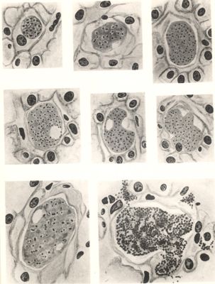 Schizonti del Plasmodium cynomolgi e del Plasmodium vivax