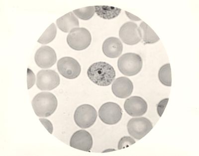 Ciclo sessuale nel sangue dell'uomo del Plasmodium vivax