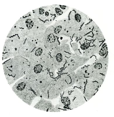 Bacilli della sifilide