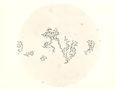 Micro colonie di Flei