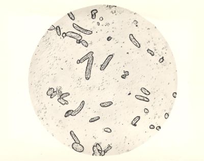 Colonie di Mycobacterium phlei in terreno liquido