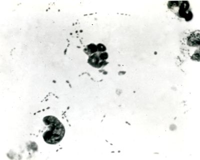 Streptococchi degenerati nell'essudato addominale di un topo trattato con Prontosil