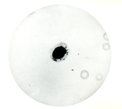 Forte fagocitosi di streptococchi nell'essudato addominale di un topo trattato con Prontosil