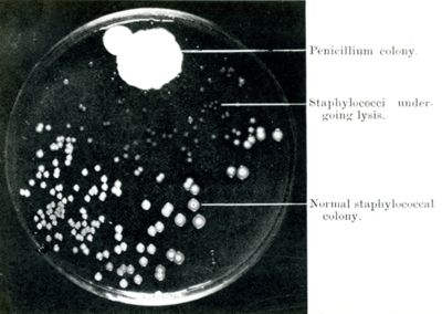 Esperienze sull'azione batteriostatica della Penicillina