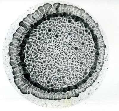 Pluricoltura di streptococco emolitico e Pluricolonia di streptococco non emolitico