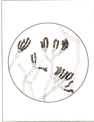 Ife di Penicillium notatum, con i carratteristici sterigmi, al di sopra dei quali trovasi, sotto forma di catenelle, i conidi o spore