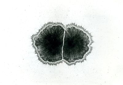 Mycobacterium tuberculosis avium - Colonie influenzatesi a vicenda