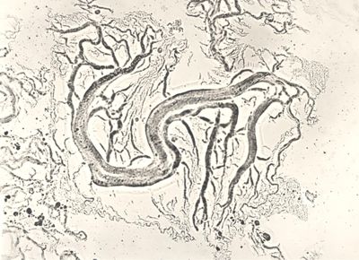 Mycobacterium sp. Ceppo Battaglini - micro colonie