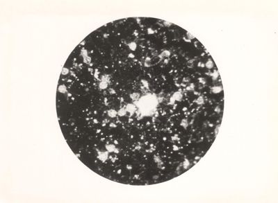 Malattia di Aujeszky (x 600). Microscopio a fluorescenza di Reichert