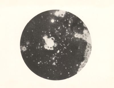 Linfa di afta epizootica (x 600). Microscopio fluorescente di Reichert