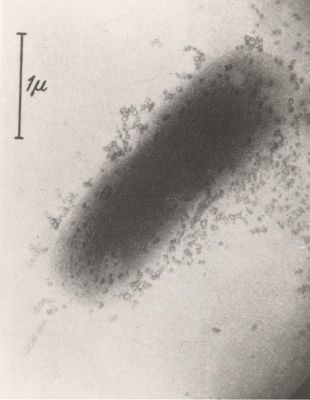 Batteriofagi (microscopio elettronico)