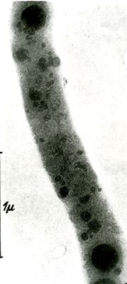 Bacillo della tubercolosi (microscopio elettronico)