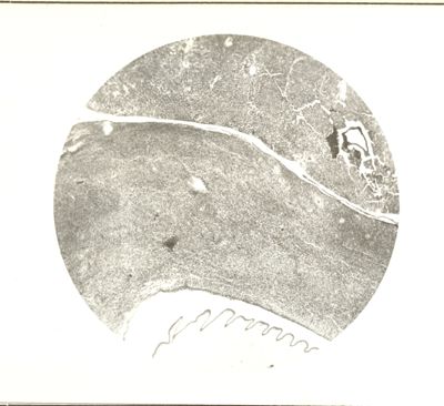 Sarcoma da Cysticercus fascicolaris