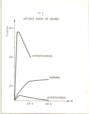 Consumo di 131 I in paziente normale e ipo o ipertiroidei