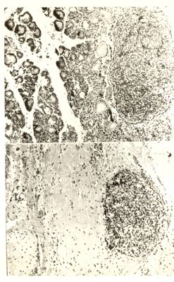 Irradiazione della tiroide del ratto con I 131 integrità perfetta della paratiroide