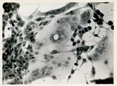 Cellule di animali e umane, normali ed infette con virus di vario tipo