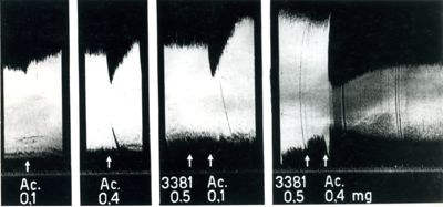 Azione del di-iodometilato di dichinolinosssioentano (3381 R.P.) sull'orecchietta isolata del cuore di coniglio
