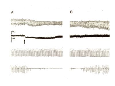 Grafici riguardanti la respirazione, pressione arteriosa, riflessi spinali e l'eccitazione muscolare del cane