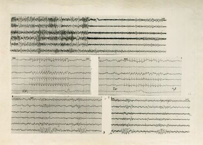 Tracciati elettroencefalografici di coniglio