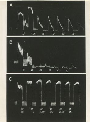 Diagrammi riproducenti l'attività spontanea e risposte all'acetilcolina dell'intestino isolato di coniglio