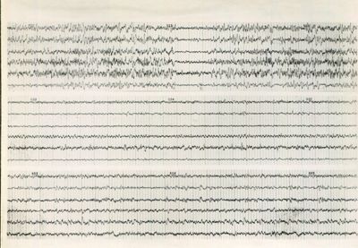 Tracciati elettroencefalografici di coniglio