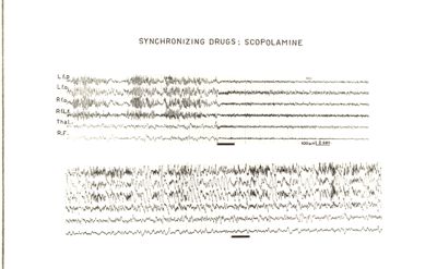 Azione della scopolamina sull'E.E.G.