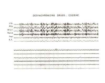 Azione dell'Eserina sull'E.E.G.