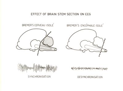 Effetti sull'E.E.G. del taglio praticato a vari livelli del tronco dell'encefalo