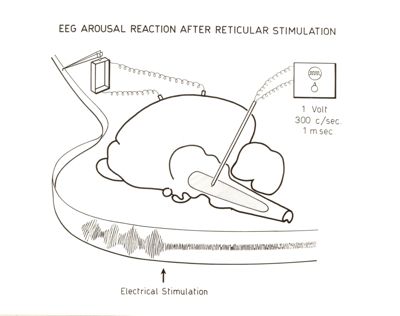 Reazione di risveglio E.E.G. dopo stimolazione elettrica dell'ipotalamo