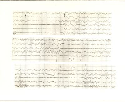 Tracciati elettroncefalografici di coniglio