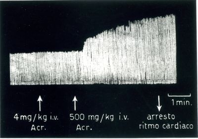 Tracciati broncografici