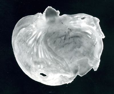 Stomaco di ratto cui è stata provocata l'ulcera gastrica sperimentale: stomaci normali in seguito a trattamento con 100 mg / 1 Kg di Parsidol