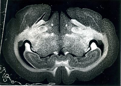 Sezioni di cervello di coniglio