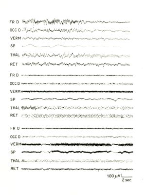 Tracciati elettroencefalografici di coniglio