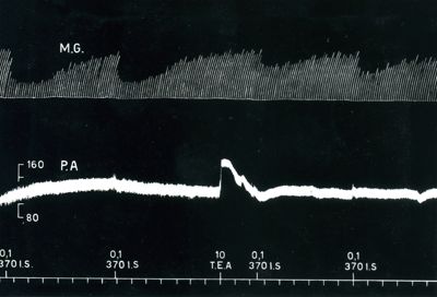 Azione del tetradilammonio sul 370 I.S.