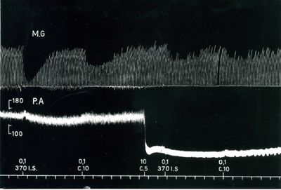 Azione del C.5 verso il 370 I.S. e il C.10