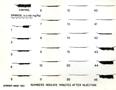 Tracciati elettromiografici