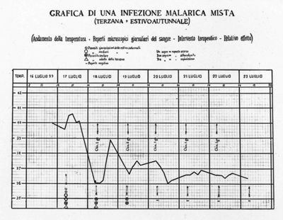 Grafico riguardante un'infezione malarica mista (terzana estivo autunnale)