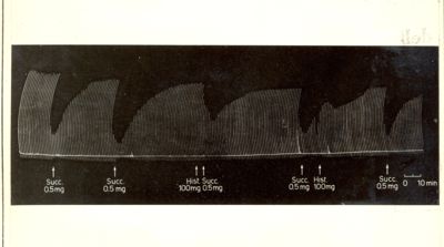 Azione delle istamine nei confronti della succinilcolina sulla trasmissione neuromuscolare