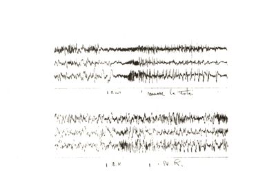 Elettroencefalogrammi di coniglio