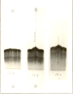 Elettroforesi incrociati