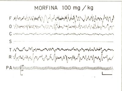 Elettroencefalogrammi di conigli