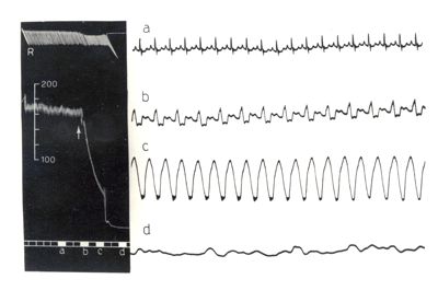 Lavoro sul 2099 I.S. - Derivato del Bispidoli Cardio Tossico