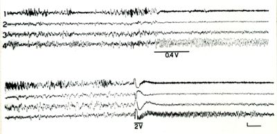 Elettroencefalogrammi di coniglio