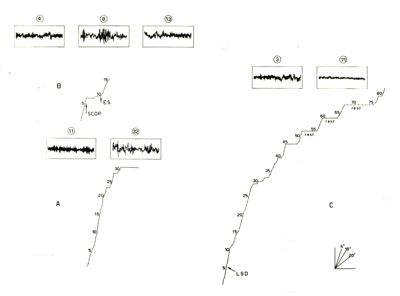 Comportamento del coniglio condizionato e relativo tracciato EEG