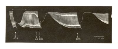 Azione dell'eserina e della succinilcolina sulla preparazione del gastrocnemio dell'uccello