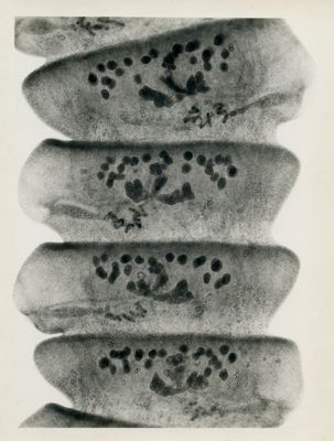 Proglottidi di Raillietina cesticillus di diverse tipologie