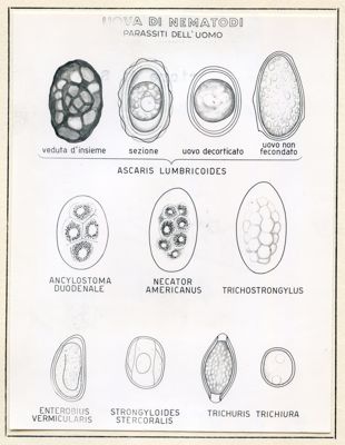 Immagini raffiguranti uova di Trematodi (parassiti dell'uomo) e Trematodi digenetici