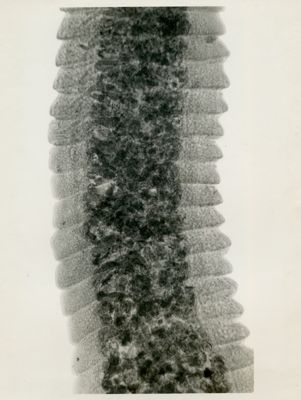 Hymenolepis tetragona proglottine gravide