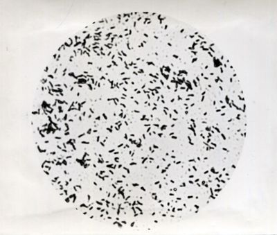 Immagini di Mycobacterium phlei,specie di batteri acido-resistenti caratterizzato da una rapida crescita